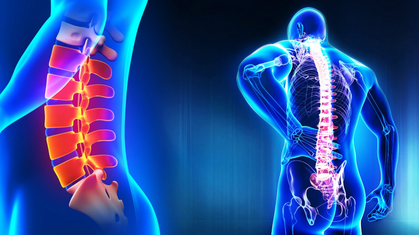 Spine Problem solution doctor in ahmedabad
